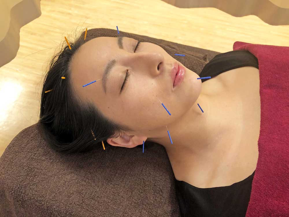 INDIBAフェイシャルの写真