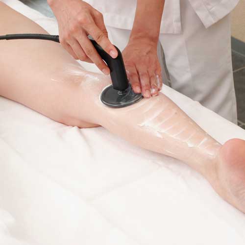 鍼灸治療の写真