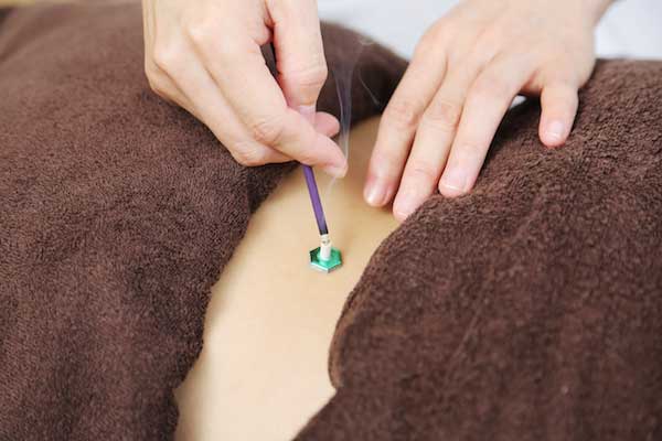 保険治療の鍼灸施術療養の写真