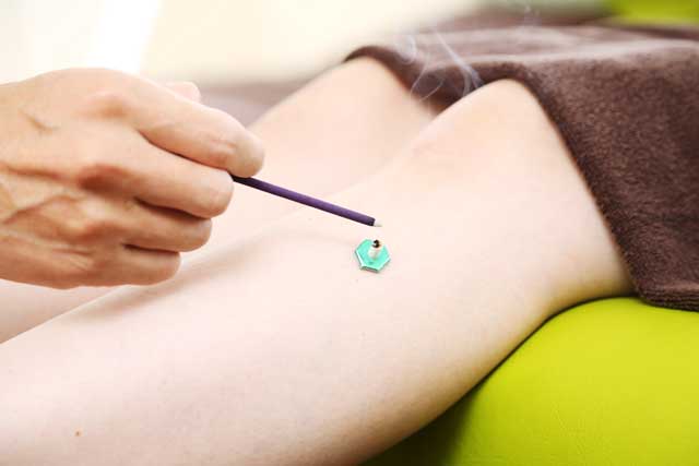 鍼灸治療中の写真